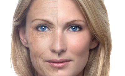 Tratamiento Anti Aging (antiedad)